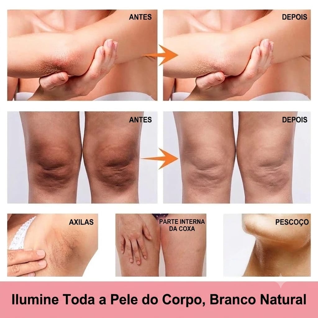 Comparativo antes e depois em cotovelos, joelhos, axilas e pescoço